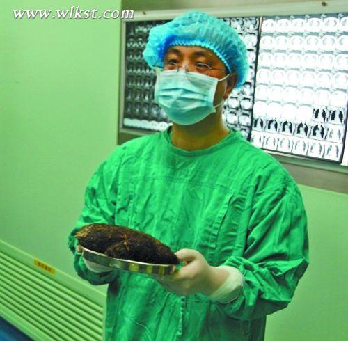 女孩患怪病爱吃<em>头发</em> <em>胃</em>中取出<em>头发</em>1斤 - 武隆旅